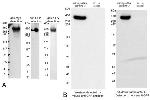 Myc Tag Antibody in Western Blot (WB)