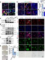 Angiogenin Antibody in Neutralization (Neu)