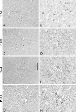PRDX3 Antibody in Immunohistochemistry (IHC)