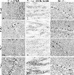 PRDX3 Antibody in Immunohistochemistry (IHC)