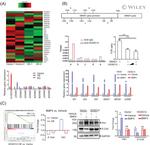 HOXD13 Antibody in Immunoprecipitation, ChIP Assay (IP, ChIP)