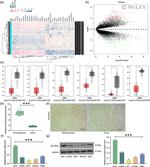 SLC30A3 Antibody in Western Blot (WB)