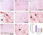 Bax Antibody in Immunohistochemistry (IHC)