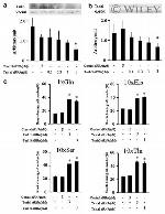 TAS1R1 Antibody in Western Blot (WB)