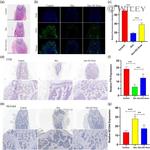 NCOA4 Antibody in Immunohistochemistry (IHC)