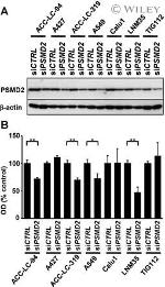 PSMD2 Antibody in Western Blot (WB)