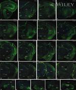GFP Antibody in Immunocytochemistry (ICC/IF)