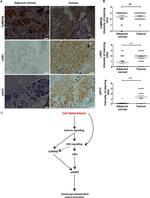 CaMKK beta Antibody in Immunohistochemistry (IHC)