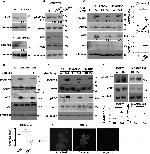 CaMKK beta Antibody in Western Blot (WB)