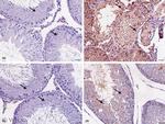 Caspase 3 Antibody in Immunohistochemistry (IHC)
