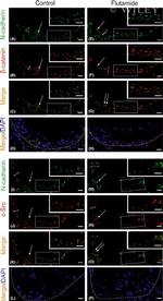 beta Catenin Antibody in Immunohistochemistry (Paraffin) (IHC (P))