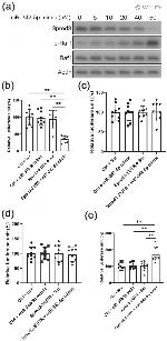 SPRED3 Antibody in Western Blot (WB)