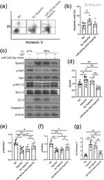 SPRED3 Antibody in Western Blot (WB)