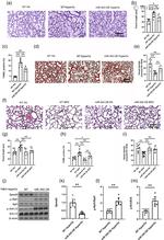 SPRED3 Antibody in Western Blot (WB)