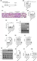 SPRED3 Antibody in Western Blot (WB)