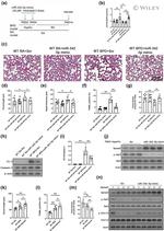 SPRED3 Antibody in Western Blot (WB)