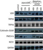 PMCA1 ATPase Antibody in Western Blot (WB)