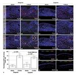 CD68 Antibody in Immunohistochemistry (IHC)