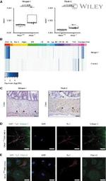 Fibulin 2 Antibody in Immunohistochemistry, Immunocytochemistry (IHC, ICC/IF)