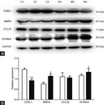 CDKL1 Antibody in Western Blot (WB)