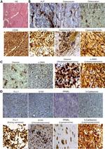 SPARC Antibody in Immunohistochemistry (IHC)