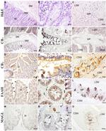 Cannabinoid Receptor 1 Antibody in Immunohistochemistry (IHC)