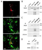 NMDAR2B Antibody in Western Blot, Immunocytochemistry (WB, ICC/IF)
