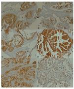 EBP50 Antibody in Immunohistochemistry (IHC)