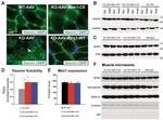 SERCA1 ATPase Antibody in Western Blot (WB)