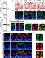 beta Catenin Antibody in Immunohistochemistry, Immunocytochemistry (IHC, ICC/IF)