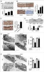 DNM1L Antibody in Western Blot, Immunohistochemistry (WB, IHC)
