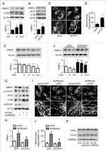 DNM1L Antibody in Western Blot (WB)