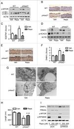 DNM1L Antibody in Immunohistochemistry (IHC)
