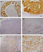Cytochrome C1 Antibody in Immunohistochemistry (IHC)