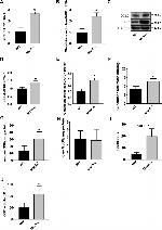 GCLC Antibody in Western Blot (WB)