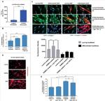 Desmin Antibody in Immunocytochemistry (ICC/IF)