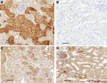 TIMP2 Antibody in Immunohistochemistry (IHC)