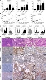 Thrombospondin 2 Antibody in Immunohistochemistry (IHC)