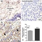 Annexin A1 Antibody in Immunohistochemistry (IHC)