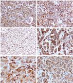SMAD3 Antibody in Immunohistochemistry (Paraffin) (IHC (P))