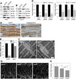 MUSK Antibody in Western Blot (WB)