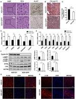 LC3B Antibody in Immunohistochemistry (IHC)