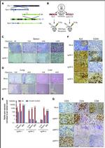CD30 Antibody in Immunohistochemistry (IHC)