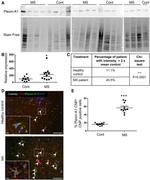 Plexin-A1 (extracellular) Antibody in Western Blot (WB)