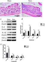 IL-1 beta Antibody in Western Blot (WB)