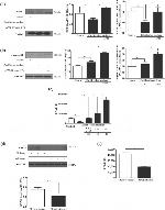 ENPP2 Antibody in Western Blot (WB)