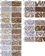 SMYD2 Antibody in Immunohistochemistry (IHC)