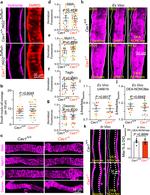 Desmin Antibody in Immunohistochemistry (Frozen) (IHC (F))