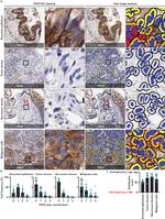 PFKP Antibody in Immunohistochemistry (IHC)