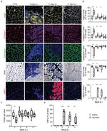 Dystrophin Antibody in Immunohistochemistry (IHC)